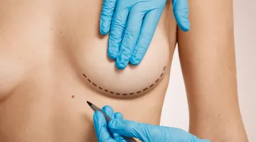Non-surgical skin treatments in Chennai